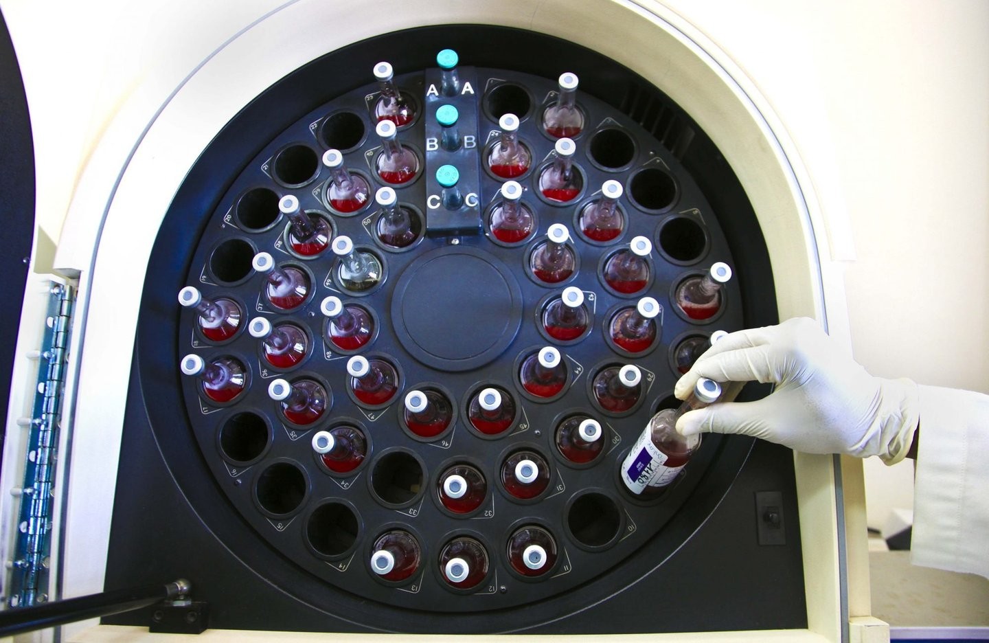 Hepatite A em Moçambique: Lições de Portugal para prevenir surtos em 2025